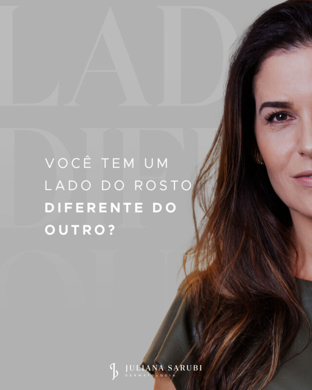 Sim, somos assimétricos e tá tudo bem!⠀
⠀
E se eu te dissesse que a assimetria faz parte da beleza natural de cada um, e que ser simétrico é que é um pouco esquisito e artificial demais?⠀
⠀
Inclusive, se pegarmos uma foto e copiarmos um lado espelhando para o outro nós mesmos nos estranhamos. Curioso não?⠀
⠀
É claro que existem assimetrias acentuadas e que merecem atenção especial, caso a pessoa se sinta desconfortável com elas.⠀
⠀
Se a sua assimetria o incomoda, agende uma avaliação e descubra qual a melhor indicação de tratamento para o seu caso.⠀
⠀
⠀
#assimetria #rostosassimetricos #dermatologiaestetica
